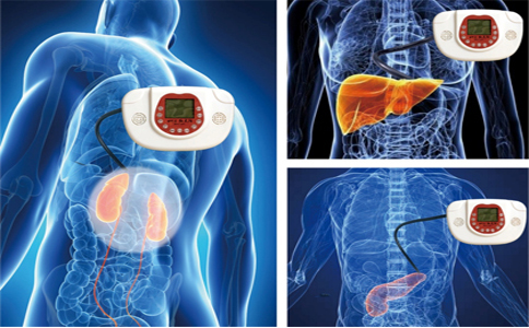 肾区离子导入技术